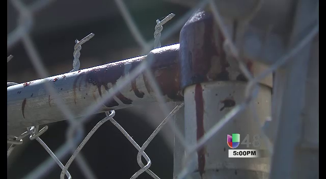 Hombre Es Consignado Despues De Haber Serruchado A Su Amigo En Mission