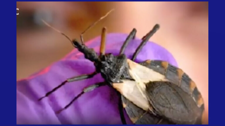 Chagas: La creciente preocupación en el sur de Texas
