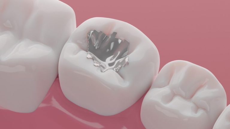 Dentista en Colorado denuncia despido injustificado por alertar sobre empastes con mercurio en prisiones