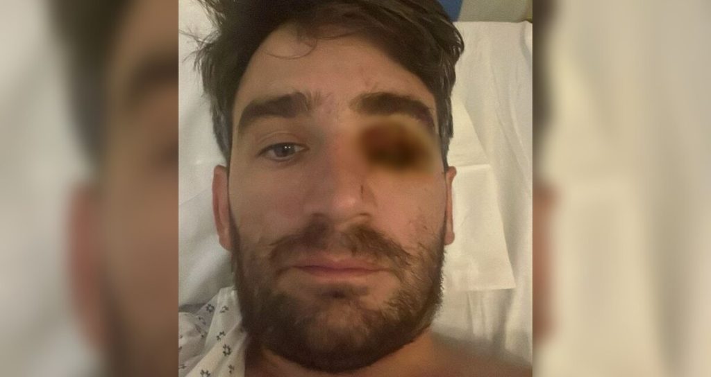 Hombre pierde un ojo en fiesta de Año Nuevo por explosión de fuegos pirotécnicos