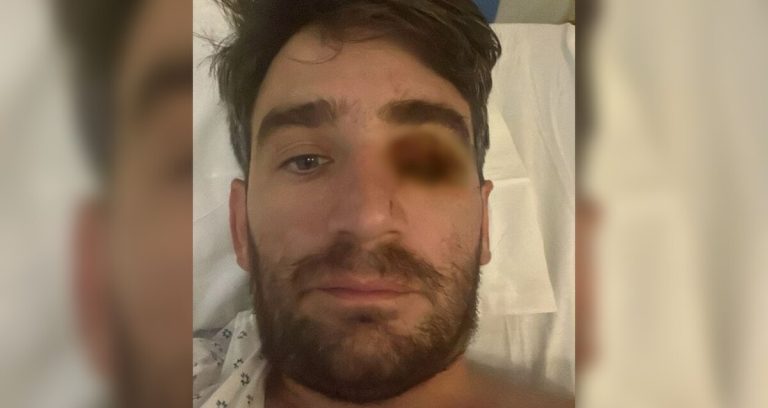 Hombre pierde un ojo en fiesta de Año Nuevo por explosión de fuegos pirotécnicos