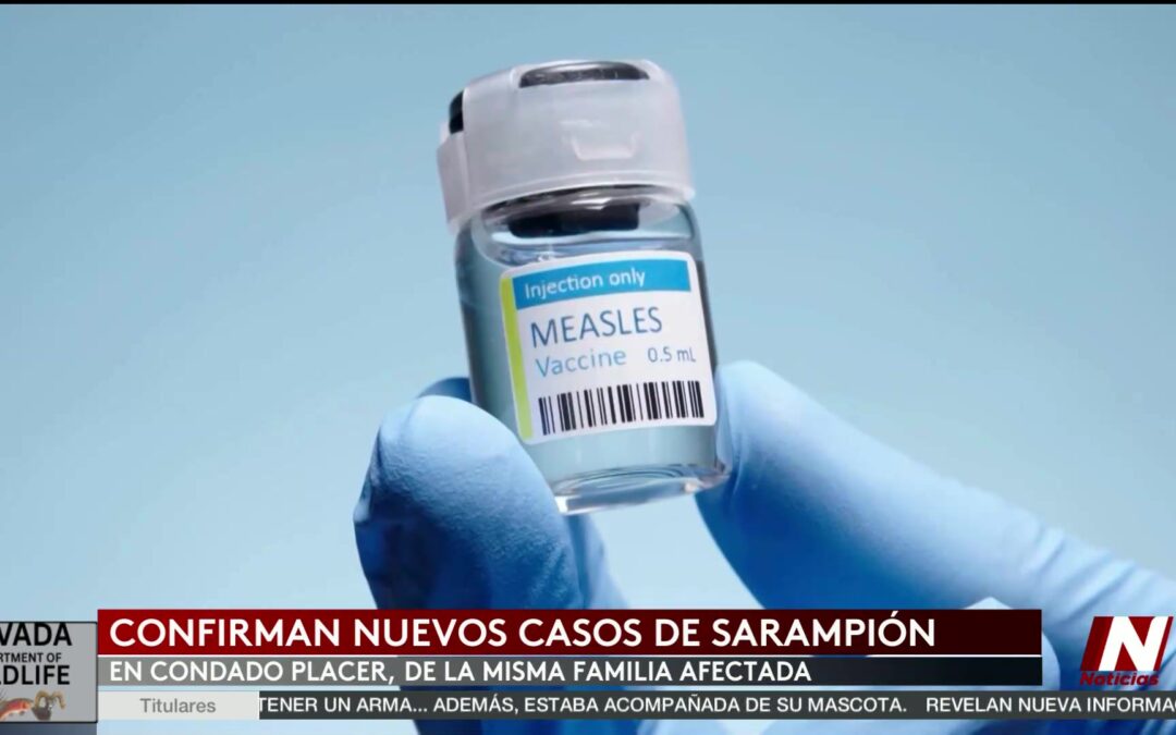 Alarma en el Condado Placer por Aumento de Casos de Sarampión