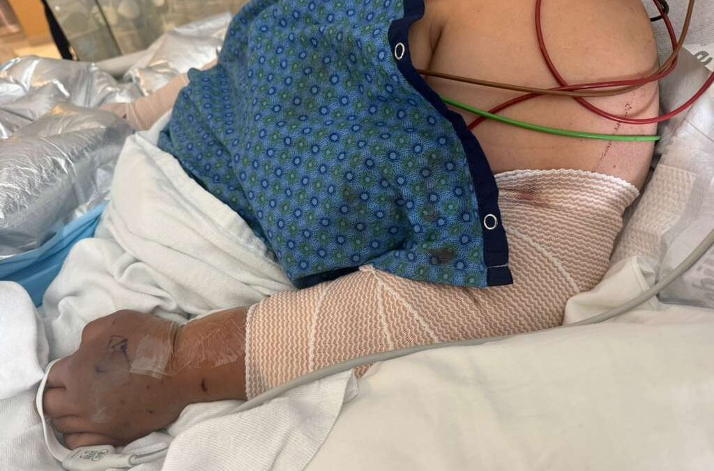Devastador ataque de perros en Aurora deja a mujer en estado crítico