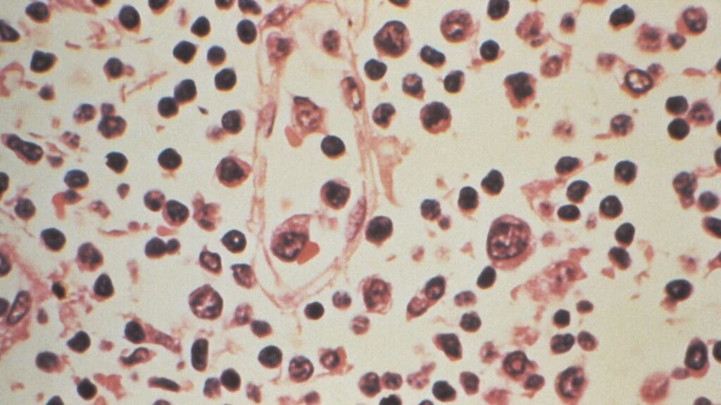 Hantavirus Kingman: Alarma por Muerte Confirmada y Peligro por Roedores