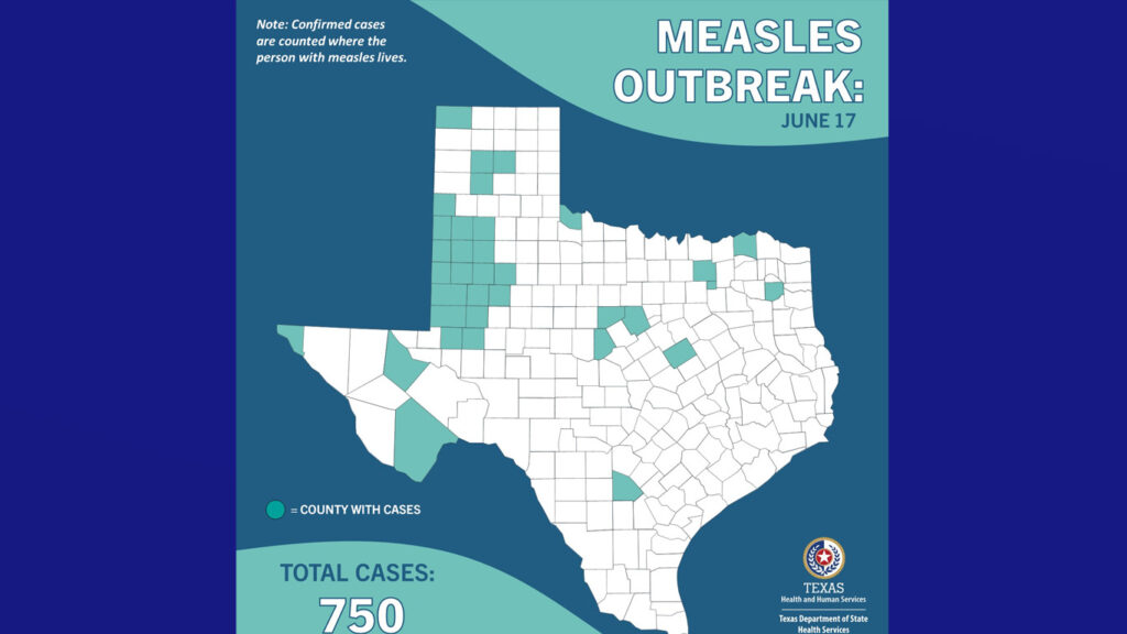 Continúa brote de sarampión en Texas; ya son 750 casos confirmados